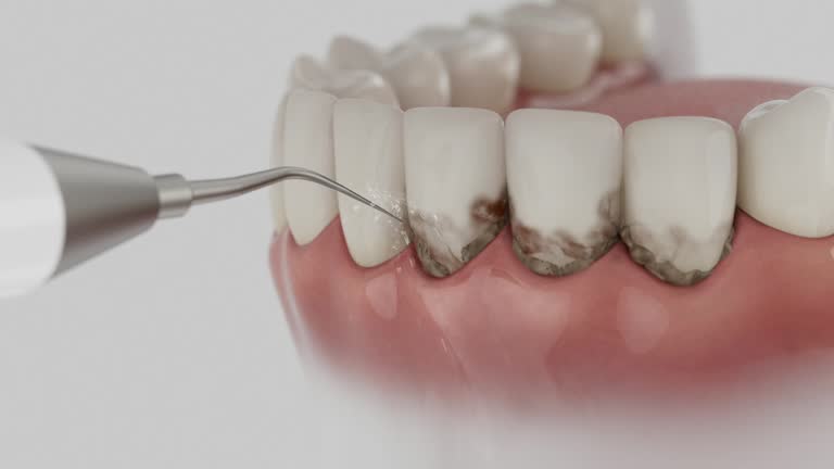 Trusted Emergency Dentist service in Liberty, SC - Dentist Open Now